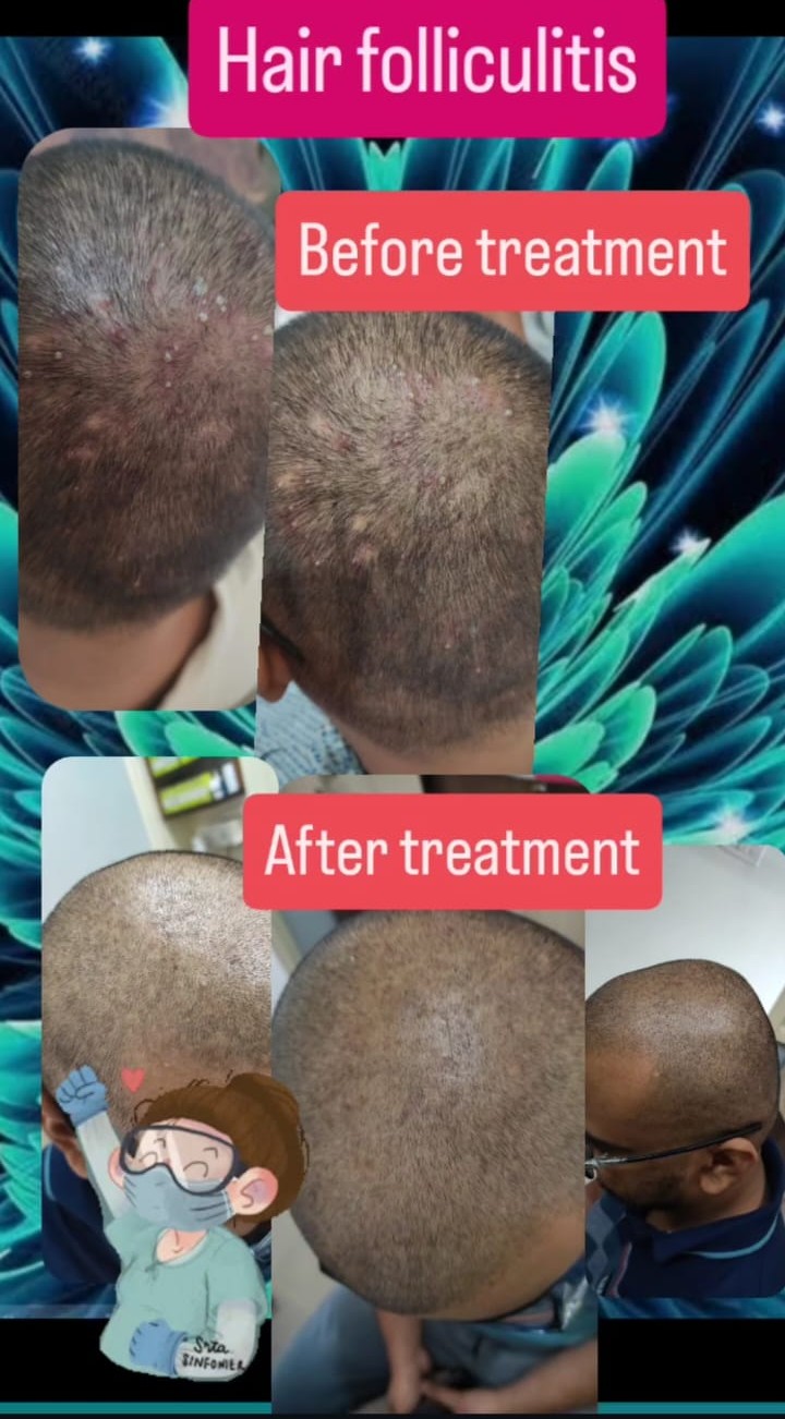 Treatment Result 3