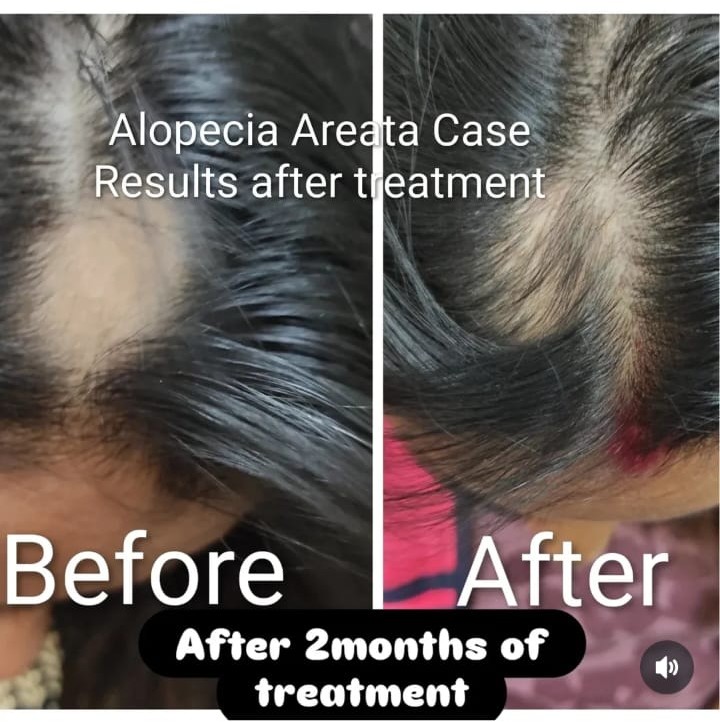 Treatment Result 4