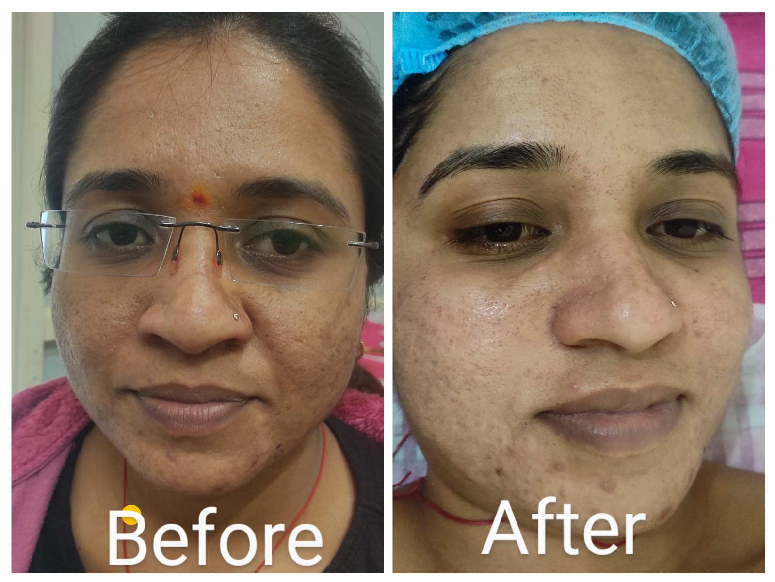 Treatment Result 7
