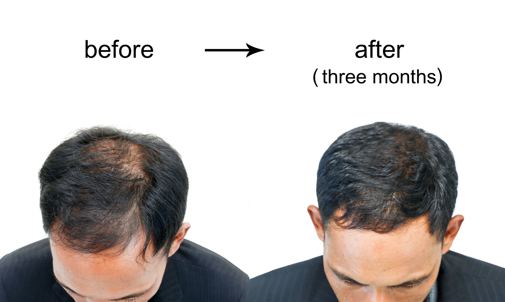 Hair treatment men